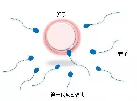 靠谱拉拉借卵助孕服务微信号
